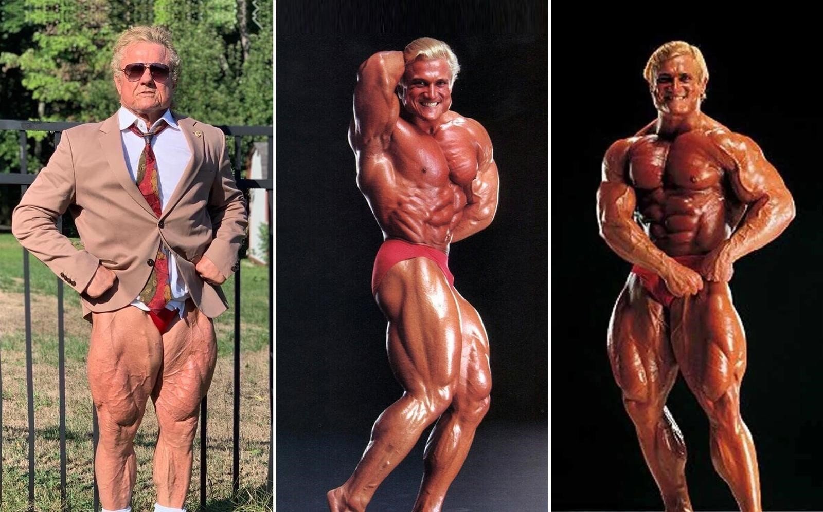 Steroids and Alopecia Steroids and Alopecia
